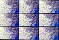 choline and magnesium trisalicylates